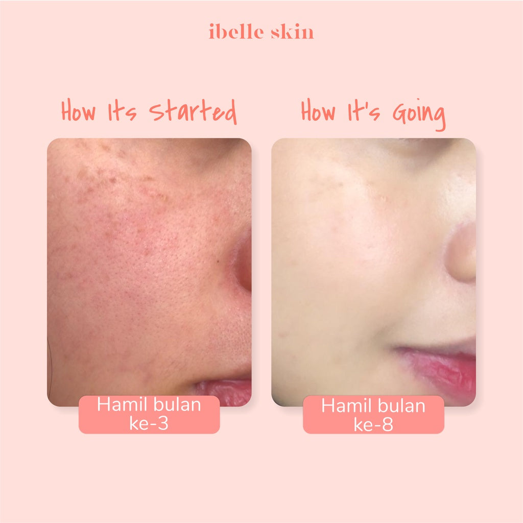 IBELLE SKIN - Night Crystal Gel