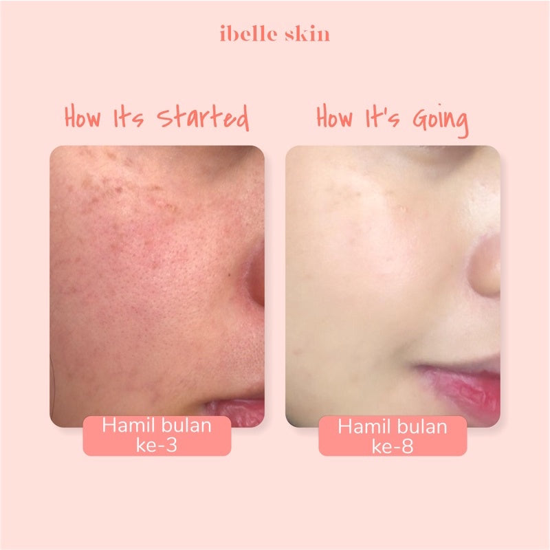 PAKET A IBELLE SKIN (Glow and Hydrate Serum + Night Crystal Gel)