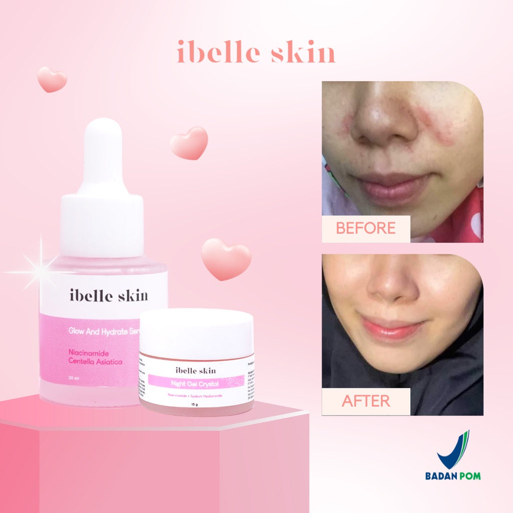 PAKET A IBELLE SKIN (Glow and Hydrate Serum + Night Crystal Gel)